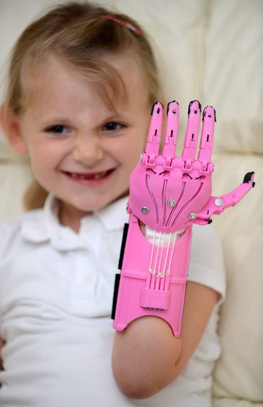 3d printed hand