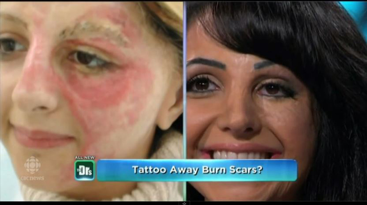 woman transformed by paramedical tattoo