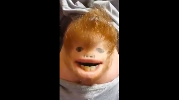 Ed SheerChin