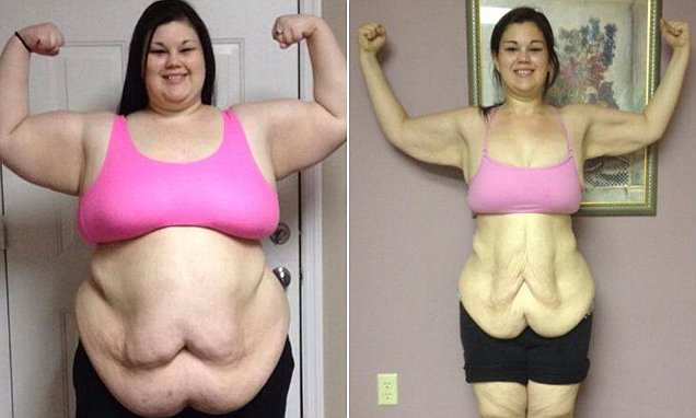 400 lb Girl Lost Half Her Weight In One Year, But Her Final