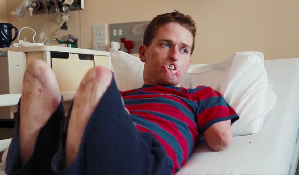 Alex Lewis on bed