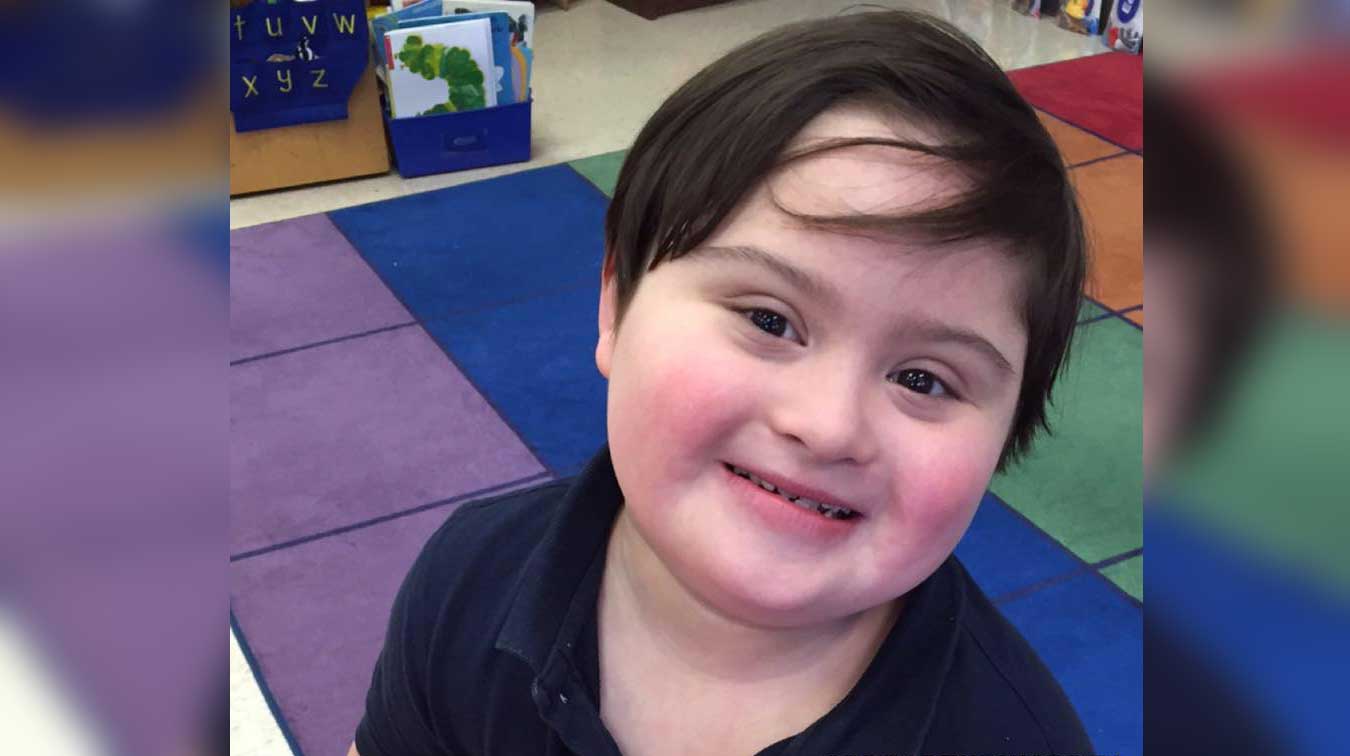 little down syndrome child