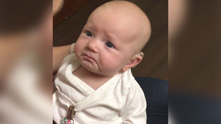 deaf baby frown