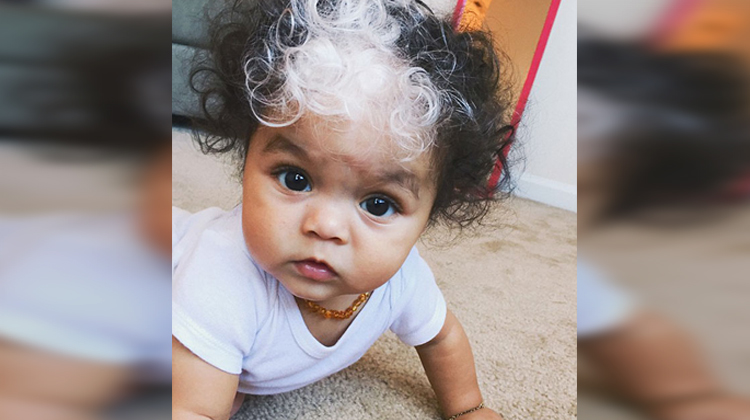 baby with white streak in hair