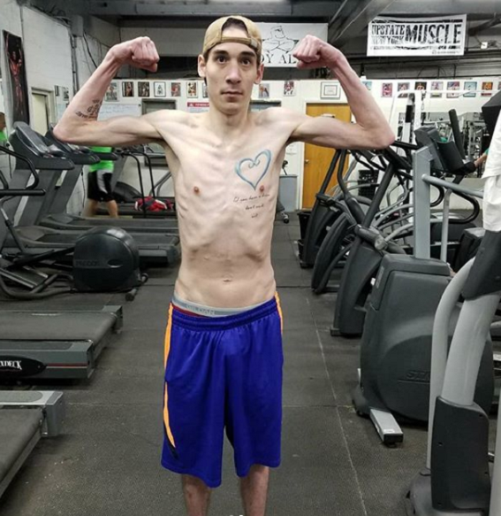 NY Man With Cystic Fibrosis Beats Cancer & Transforms Body InspireMore