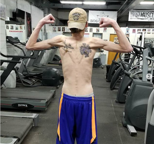 NY Man With Cystic Fibrosis Beats Cancer & Transforms Body InspireMore