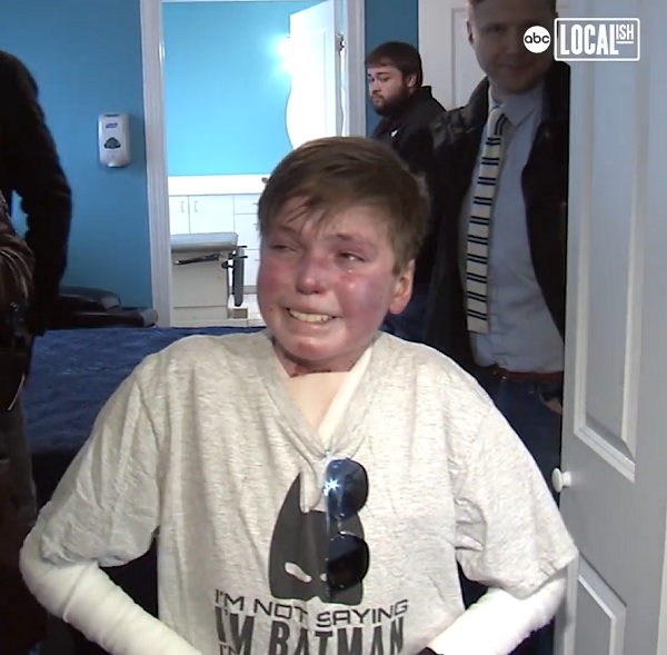 Teen With Rare Skin Condition Gets BrandNew Smart Home InspireMore