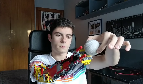 david uses prosthetic arm