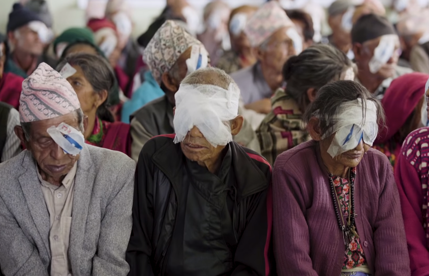 cataract patients