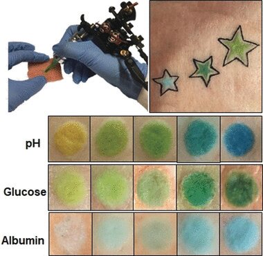 dermal tattoo sensors