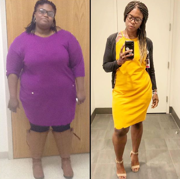liz before after weight loss
