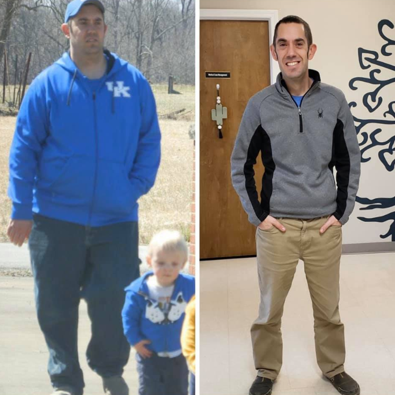 jacob before after weight loss