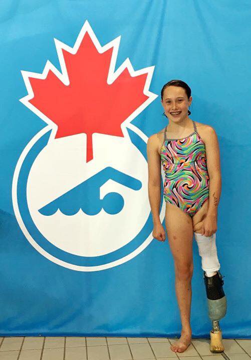 Grace Bunke swimmer with missing leg