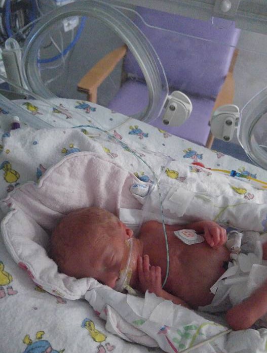 premature baby asleep in the nicu at a hospital