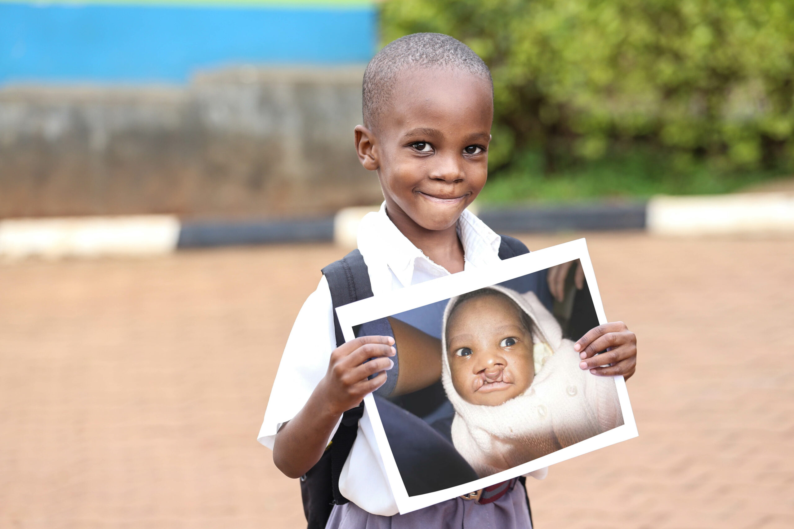 a little boy named livingstone standing outside and smiling as he holds a phot of himself as a baby back when he had a cleft