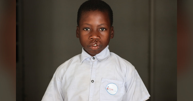 a little boy named nkunda, who has a cleft, posing for a photo