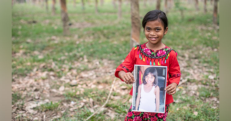 little girl born with a cleft holding up before surgery picture