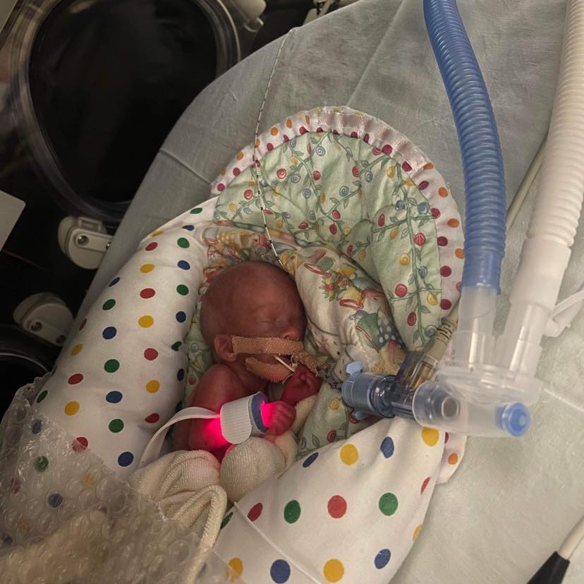 a premature baby named hannah stibbles sleeping in a bassinet while hooked up to a machine