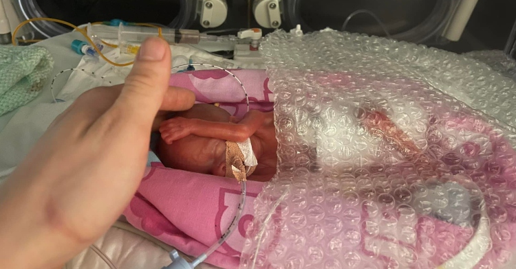 someone's hand gently petting the head of a premature baby named hannah stibbles who is laying in the icu