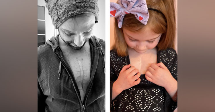 dad with chest tattoo next to daughter with heart surgery scar