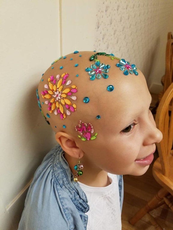 a seven year old girl with alopecia wearing various colorful jewels on her bald head