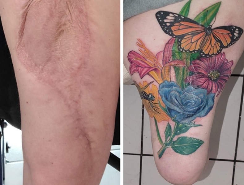 tattoo scar cover up