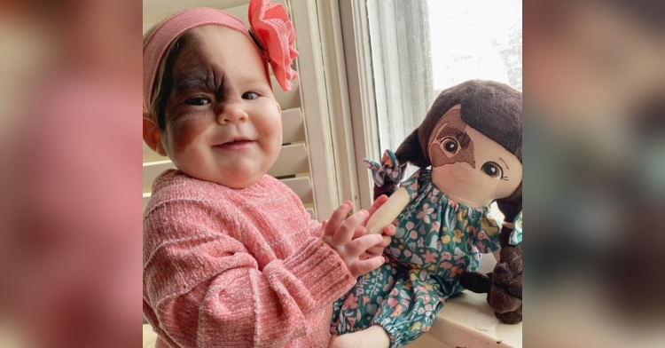 a baby named winry, who has congenital melanocytic nevi (cmn), smiling as she plays with a doll that has a matching cmn