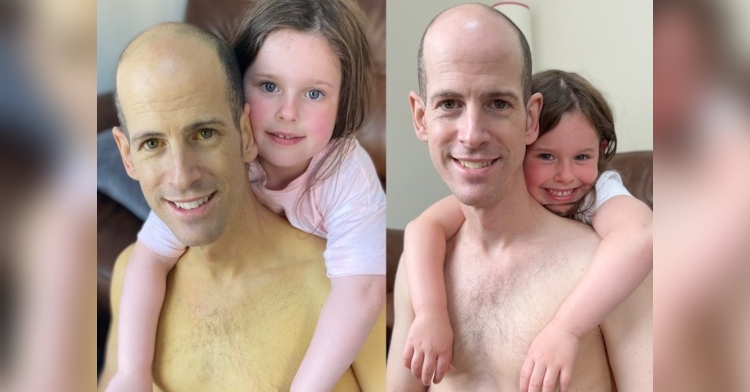 a two-photo collage. the first is of gareth smiling as his daughter is draped over his back, arms dangling on his chest, as she smiles, too. gareth's skin is yellowed and his stomach is bloated. the second is a recreation of the first photo except, this time, gareth's skin looks healthy, his stomach isn't bloated, and there's a large scar on his abdomen from surgery.