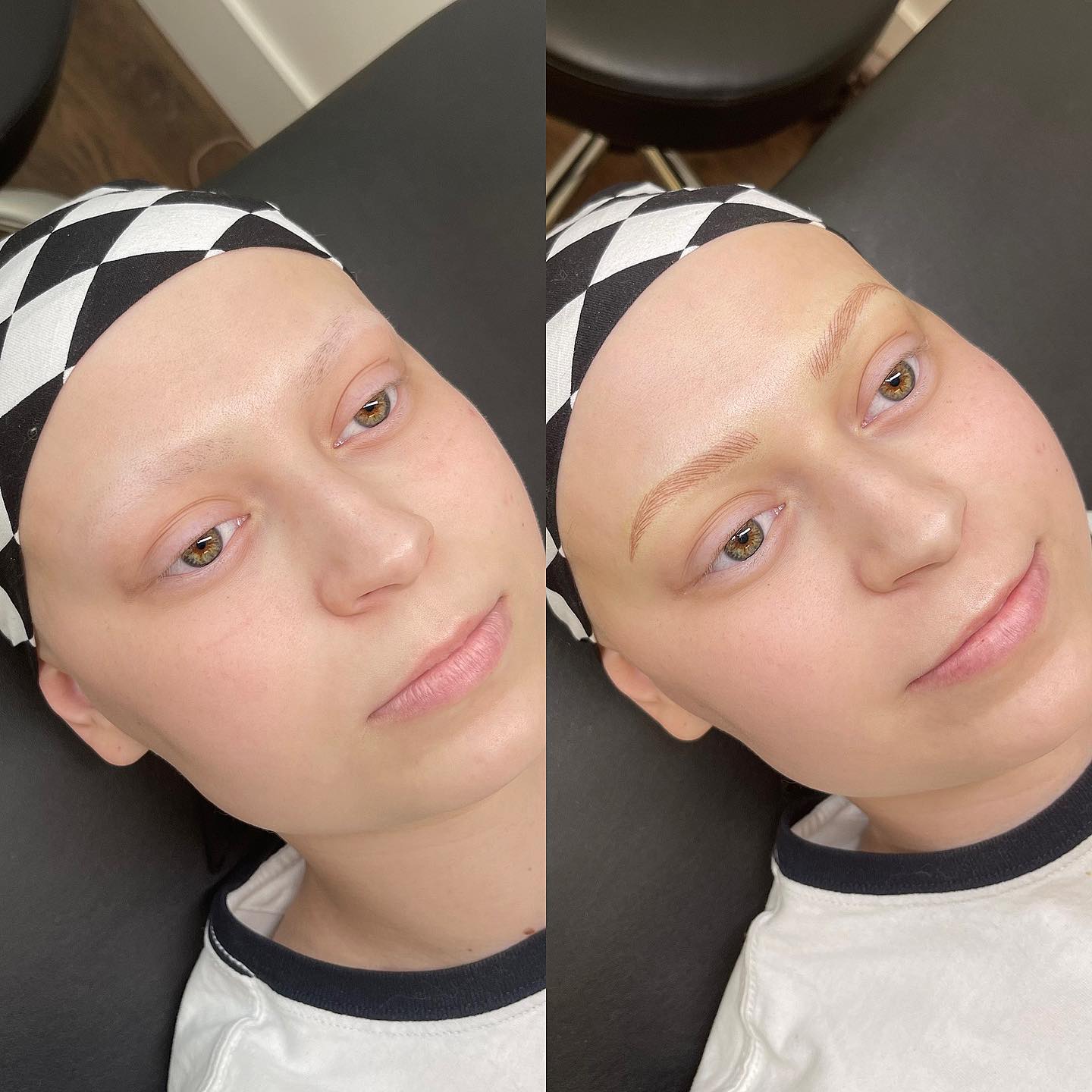 cancer patient before and after having eyebrows microbladed.