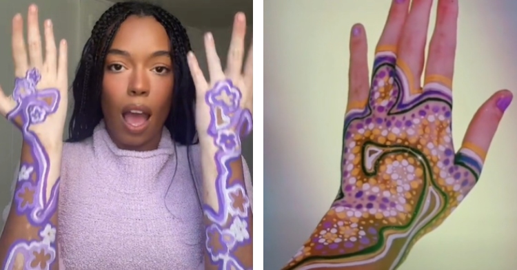 Amara Aleman shows off her "art spots," painted vitiligo spots