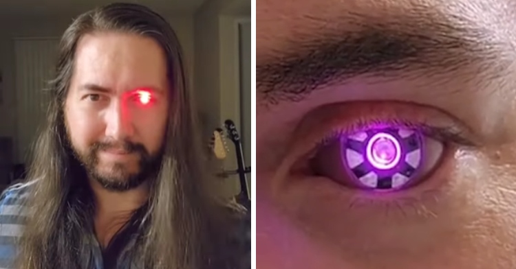 Cancer Survivor Creates Bionic Eye That Looks Like Terminator