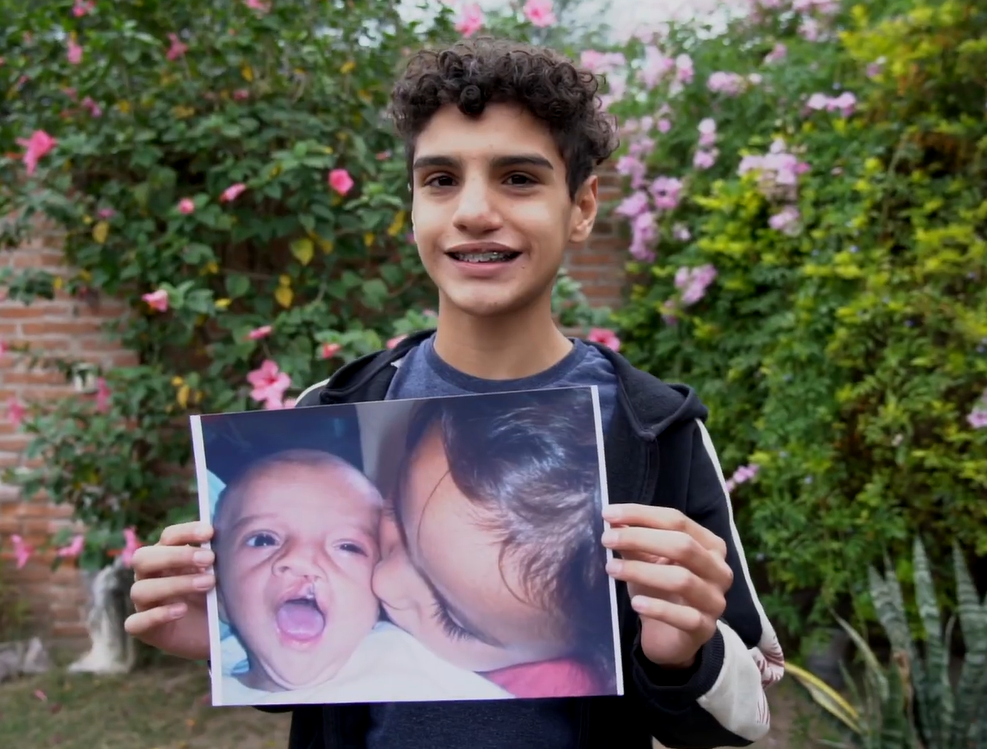 Nazareno holds up a baby picture of himself before cleft repair