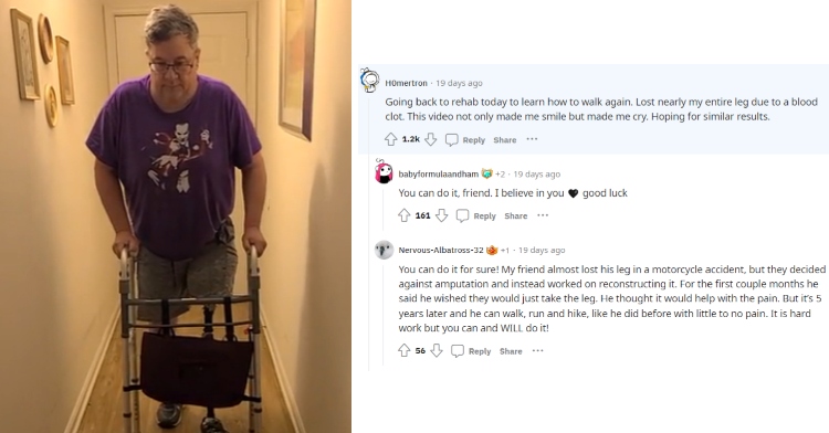 A two-photo collage. The first shows a man with an amputated leg walking down the hall with a walker. The second shows a screenshot of a comment he made on Reddit along with kind replies.
