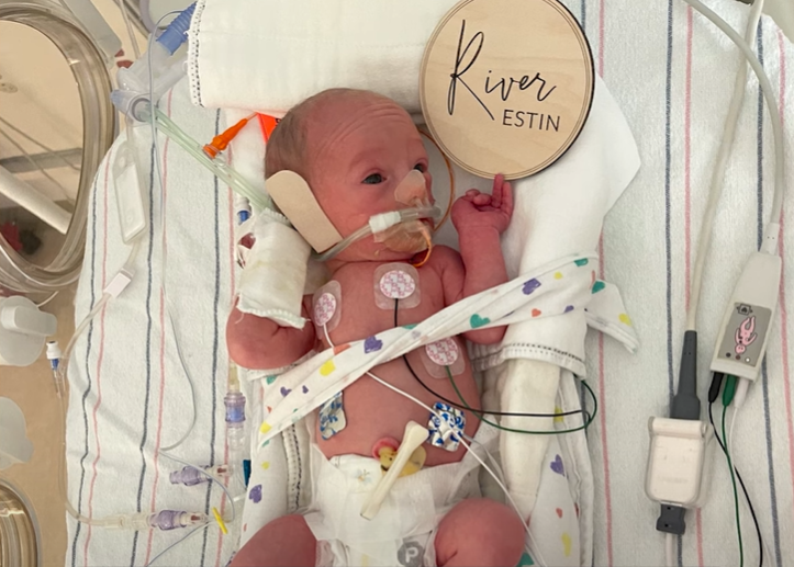 Baby River lays in a hospital bassinet, tubes and wires all over. His eyes are open. A sign near him reads "River Estin."