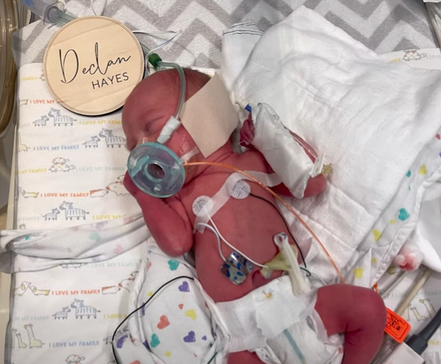 Baby Declan lays in a hospital bassinet, tubes and wires all over. His eyes are closed. A sign near him reads "Declan Hayes"