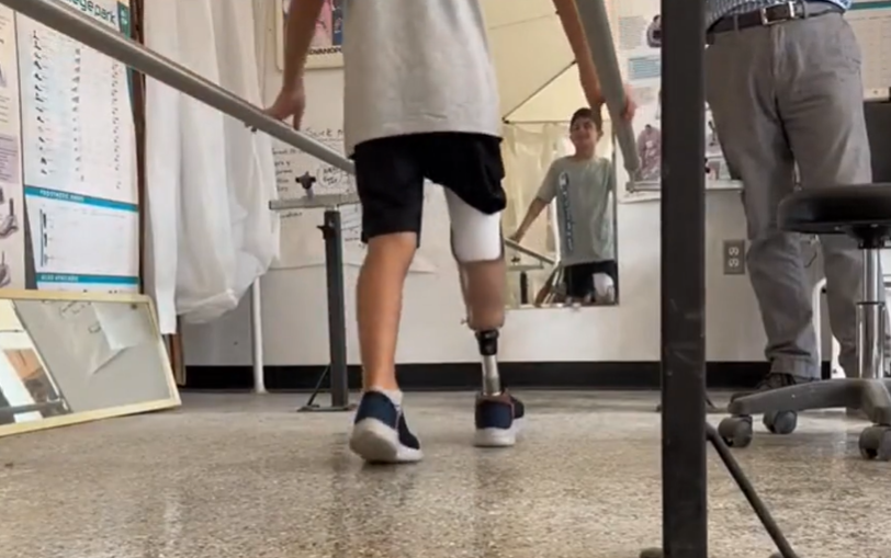Saleh received therapy to walk on his prosthetic leg.