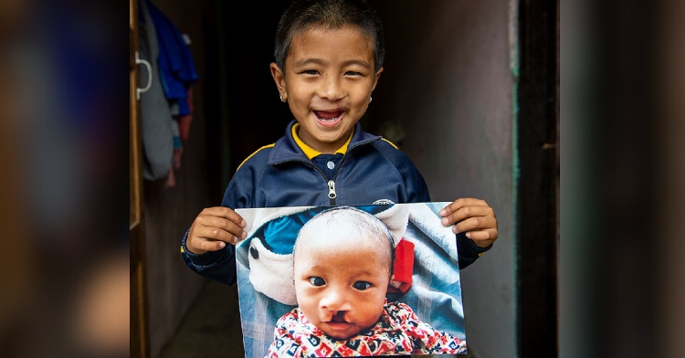 A little boy smiles as he holds up a photo. The photo is of himself when he was a baby and before he had cleft care.