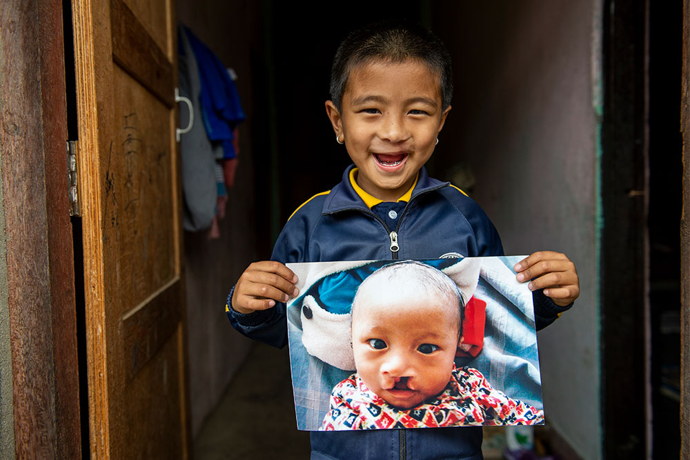 A little boy smiles as he holds up a photo. The photo is of himself when he was a baby and before he had cleft care.