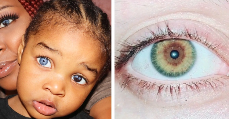 A two-photo collage. The first shows a close up of a Mom holding her kid. We can only see one of her eyes, but both of them have sectoral heterochromia eyes that are both blue and brown. The second photo shows a close up of an eye with three different colors in their eyes in three distinct sections.