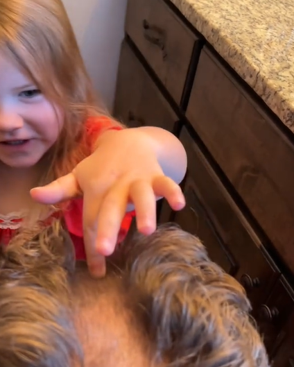 little girl touches bald spot