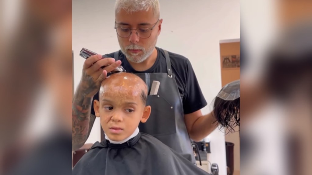 A barber shaves a kid's head as he sits still, a serious look on his face. The kid is a burn victim, as can be seen on the top of his scalp. In one hand, the barber holds onto what looks like a kind of toupee.