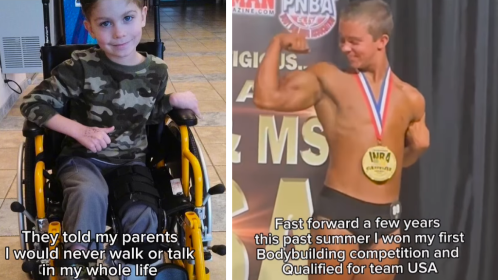 two images: one of hunter moore as a child in a wheelchair, and the other of hunter flexing his muscles after winning a bodybuilder competition