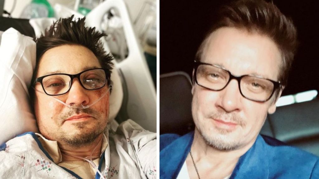 Left image shows Jeremy in the hospital after his snowplow accident. Right image shows him following his miraculous recovery.
