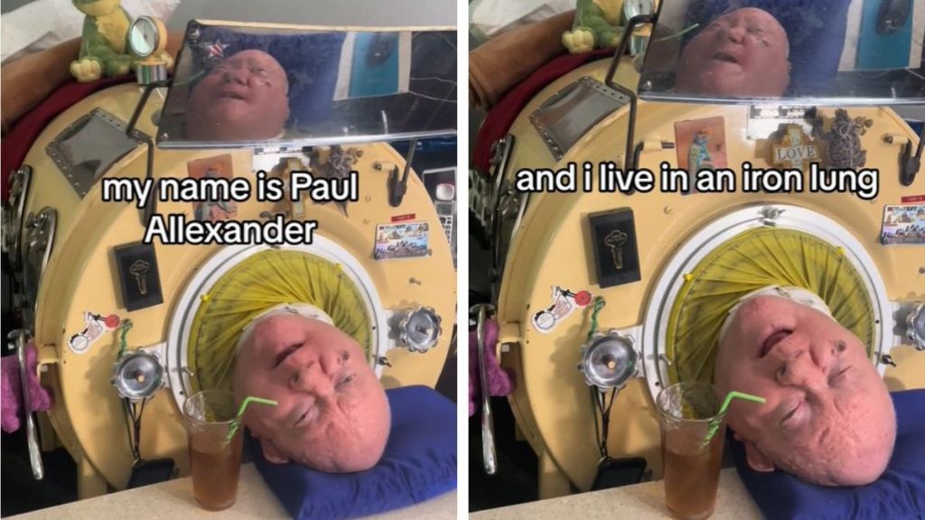 Image shows a man in an iron lung with words that say, "my name is Paul Alexander" (left) and "and I live in an iron lung." (right)