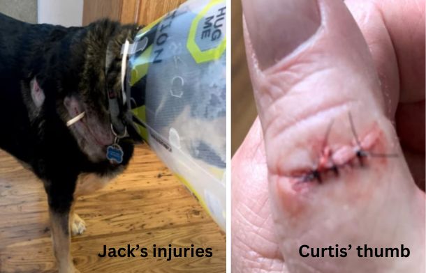 Left image shows the injuries to Jack, a rottweiler. Right image shows the injuries to Jack's Owner, Curtis.