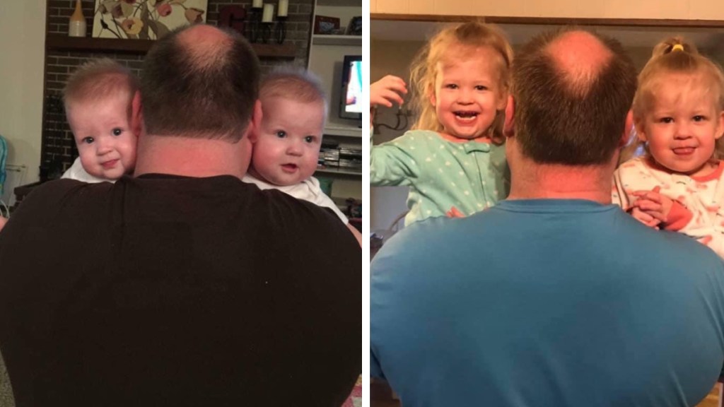 A two-photo collage. The first shows a man whose back is facing the camera. He's standing in a living room. He's holding a twin on each side. The babies are facing the camera. Both of them look amused. The second image shows that same man's back back toward the camera. Two years have passed. His twins smile as they rest on his shoulders. A dining room can be seen at this angle.