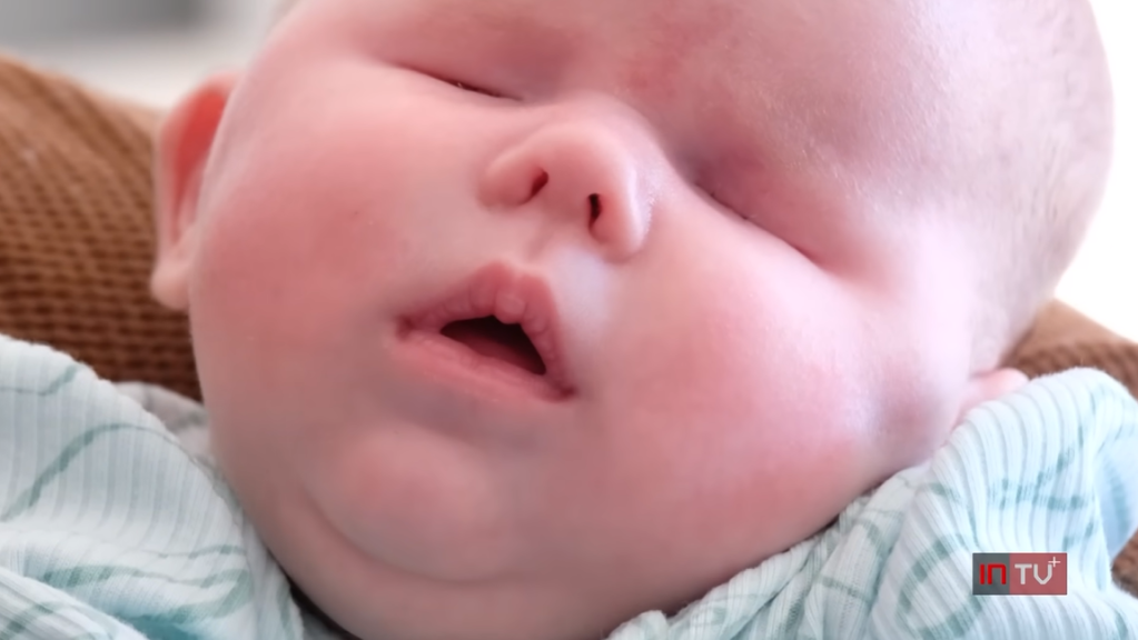 Close up of a baby without eyes. 