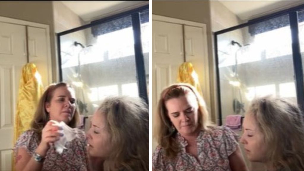 Left image shows a mom removing bandages after her daughter had an eye removed. Right image shows the mom's first view without the bandages.