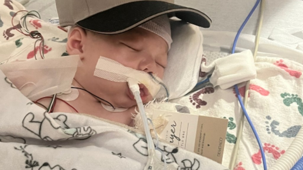 A small baby rests his eyes while hooked up to machines at a hospital.