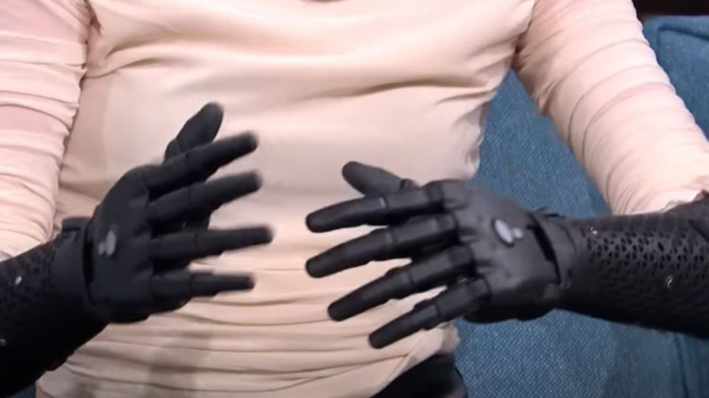 Image shows Tilly Lockey modeling her wireless bionic hands.